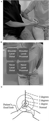 Validity and Reliability of the Semmes-Weinstein Monofilament Test and the Thumb Localizing Test in Patients With Stroke